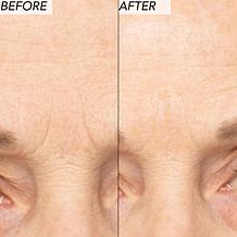 Nakery Beauty 2-Piece Supersize Firm + Lift Collection - Auto-Ship®