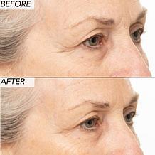 Nakery Beauty 2-Piece Supersize Firm + Lift Collection - Auto-Ship®