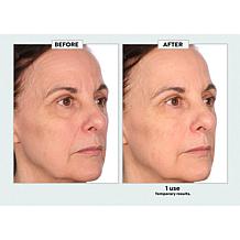 Nakery Beauty Advanced Instant Wrinkle Eraser Auto-Ship®