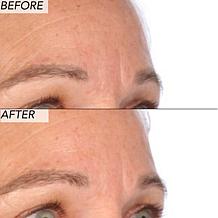 Nakery Beauty Advanced Resurfacing Microderm Scrub