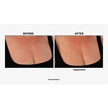 Nakery Beauty Firm + Wrinkle-Reducing Neck + Dec Serum Auto-Ship®