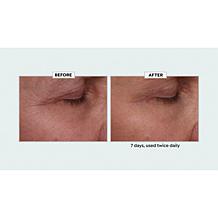 Nakery Beauty Lift-TOX 360 Firming Eye Lift Treatment Cream Auto-Ship®