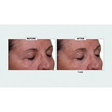 Nakery Beauty Lift-TOX 360 Firming Eye Lift Treatment Cream