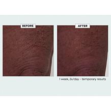 Nakery Beauty Lift-TOX Body Treatment