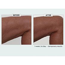 Nakery Beauty Lift-TOX Body Treatment