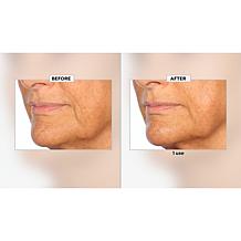 Nakery Beauty Peptide-Surge Intense Collagen Concentrate Auto-Ship®