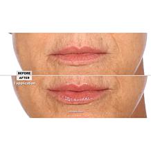 Nakery Beauty Plumping & Line-Smoothing Lip Treatment