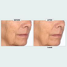 Nakery Beauty SkinRecovery Make it Vanish Power Cream w/Erase Complex