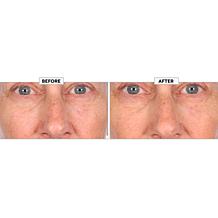 Nakery Beauty SkinRecovery The Age Edit Serum + Night Shift Concent...