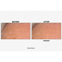 Nakery Beauty Skip the Line Instant Wrinkle Eraser Auto-Ship®