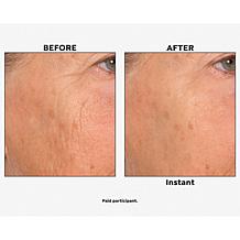 Nakery Beauty Skip the Line Instant Wrinkle Eraser