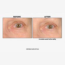 Nassif MD 2-pack Undereye Anti-Aging Smoother