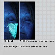 NassifMD 2-pack Detox Pads - Auto-Ship®