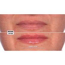 NassifMD 2-pack Pink Champagne Hydro-Screen for Lips Lip Plumper