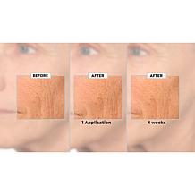 NassifMD 2-pc Best Sellers Set with Glycolic Polish Sample Auto-Ship®