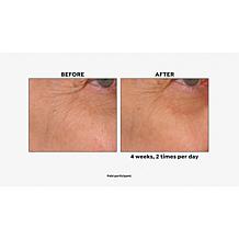 NassifMD® Age Defying Eye Renewal Serum with Dual Action Peptides AS