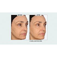 NassifMD Collagen Peptide Serum and Skincare Detox Pads Set