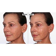 NassifMD Detox Pads & Dermaflect Day Serum Set Auto-Ship®