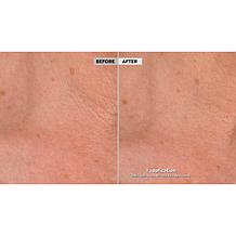 NassifMD® Detox Pads and Hydro-Screen® Face & Body Souffle Auto-Ship®