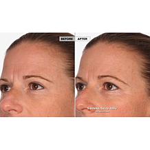 NassifMD Detox Pads and Hydro-Screen On-the-Go Set