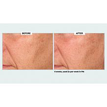 NassifMD Even & Correct Retexturizing Pads Home & Go Kit