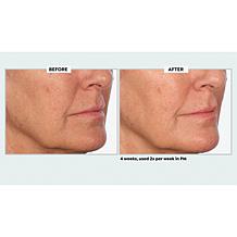 NassifMD Even & Correct Retexturizing Pads Home & Go Kit Auto-Ship®