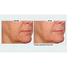 NassifMD Even, Correct & Renew Retexturizing Pads