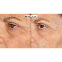 NassifMD Eye and Neck Targeted Peptide Try-Me 2-piece Set