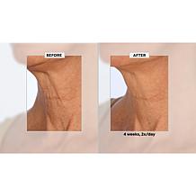 NassifMD Eye and Neck Targeted Peptide Try-Me 2-piece Set