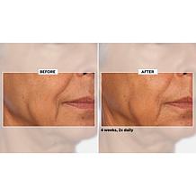 NassifMD Home and Go Niacinamide Biopeptide Serums