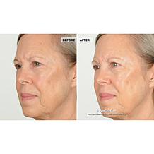 NassifMD® Hydro-Screen Hydrating Serum - Deluxe Size