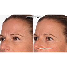 NassifMD® Hydro-Screen Hydrating Serum - Deluxe Size