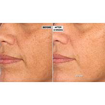 NassifMD Hydro-Screen Hydrating Serum Home & Go 2-piece Set