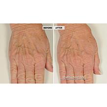 NassifMD Hydro-Screen Hydrating Serum Home & Go 2-piece Set