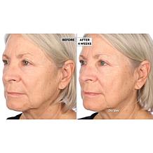 NassifMD Hydro-Screen Serum w/Hyaluronic Acid, Retinol & Ceramides AS