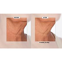 NassifMD Neck & Decollete Upfinity Peptide Complex Serum