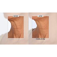 NassifMD Neck & Decollete Upfinity Peptide Complex Serum Auto-Ship®