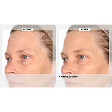 NassifMD Niacinamide Biopeptide Smoothing Serum