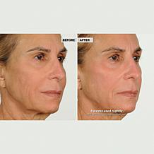 NassifMD Night Therapy Serum