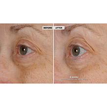 NassifMD® Peri-Orbital Eye Complex