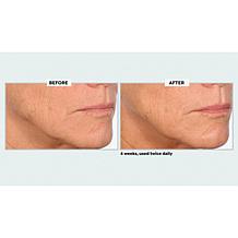 NassifMD Pro Peptide Collagen Serum