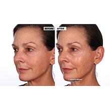 NassifMD® Pure Hydration Night Cream