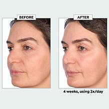 NassifMD Restore & Firm Face Oil with CoQ10