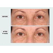 NassifMD Skin Barrier Fragrance-Free Protection Cream Auto-Ship®