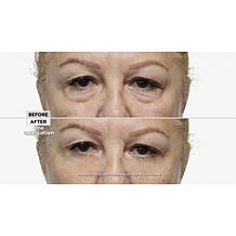 Perfect Cosmetic Perfect Eyes and Day Cream Set