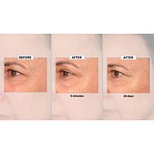 Perlier 2-pack Supersize Black Rice Flash Effect Eye Serum Auto-Ship®
