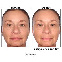 Perlier Black Rice 5-Day Brightening Serum