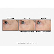 Perlier Black Rice 94.5% Pure Hyaluronic Acid Gel