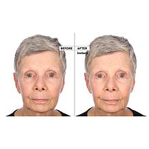 Perlier Black Rice Niacinamide Concentrate Auto-Ship®