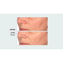 Perlier Black Rice Niacinamide Concentrate Duo